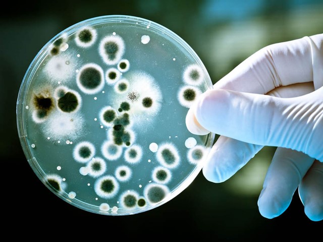 Dezynfekcja inaczej odkażanie -
                    Niszczenie drobnoustrojów chorobotwórczych: Bakterii, wirusów i grzybów środkami chemicznymi lub fizycznymi.